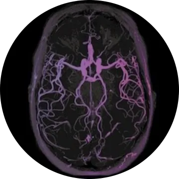 Image from an MRI of the brain