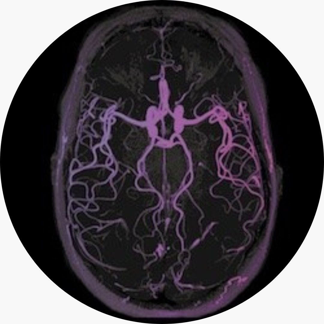 Image from an MRI of the brain